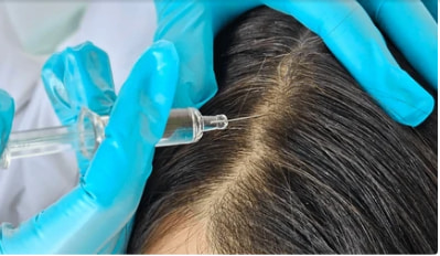 Hair Loss Treatment